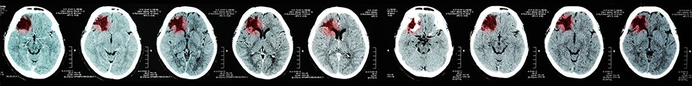 Brain topography strip